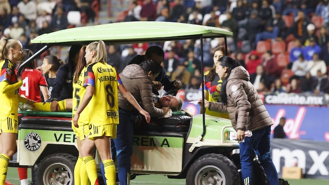 Mala noticia para América: Refuerzo termina con fractura tras partido contra Xolos de Tijuana