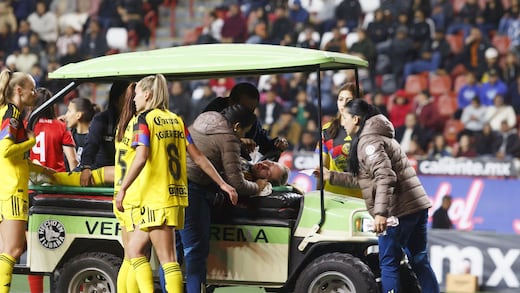 Mala noticia para América: Refuerzo termina con fractura tras partido contra Xolos de Tijuana