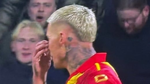 Vergüenza en la Europa League: Jugador se burló de futbolista del Stuttgart que tiene labio leporino y le cayó de todo en redes