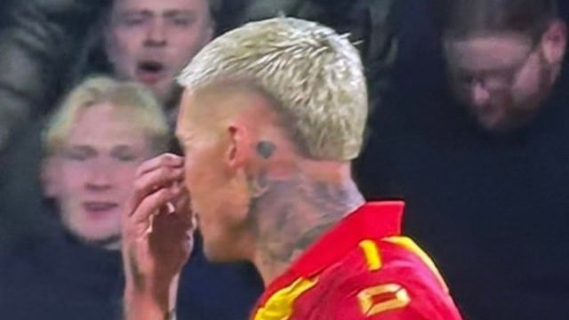 Vergüenza en la Europa League: Jugador se burló de futbolista del Stuttgart que tiene labio leporino y le cayó de todo en redes.