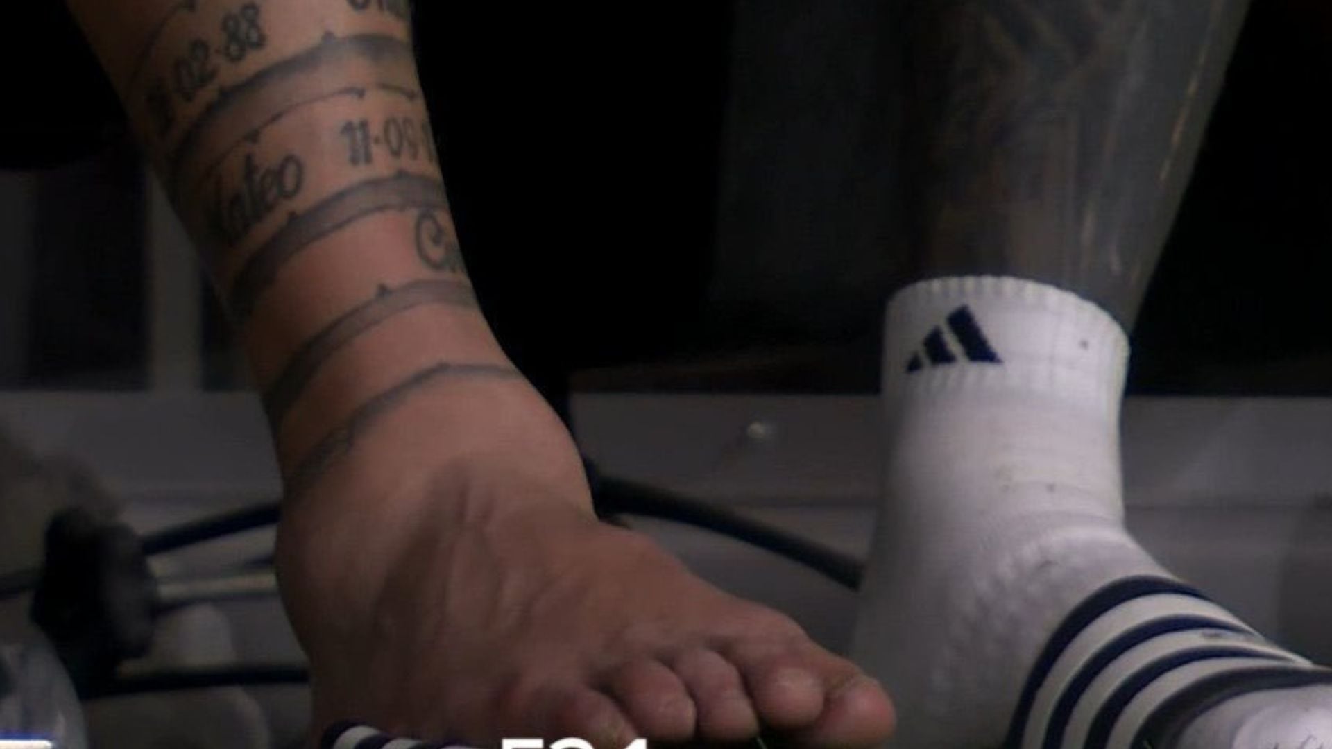 El tobillo de Lionel Messi en la Copa América