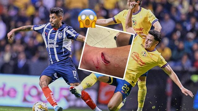 Tecatito Corona muestra brutal herida tras entrada de Ramón Juárez